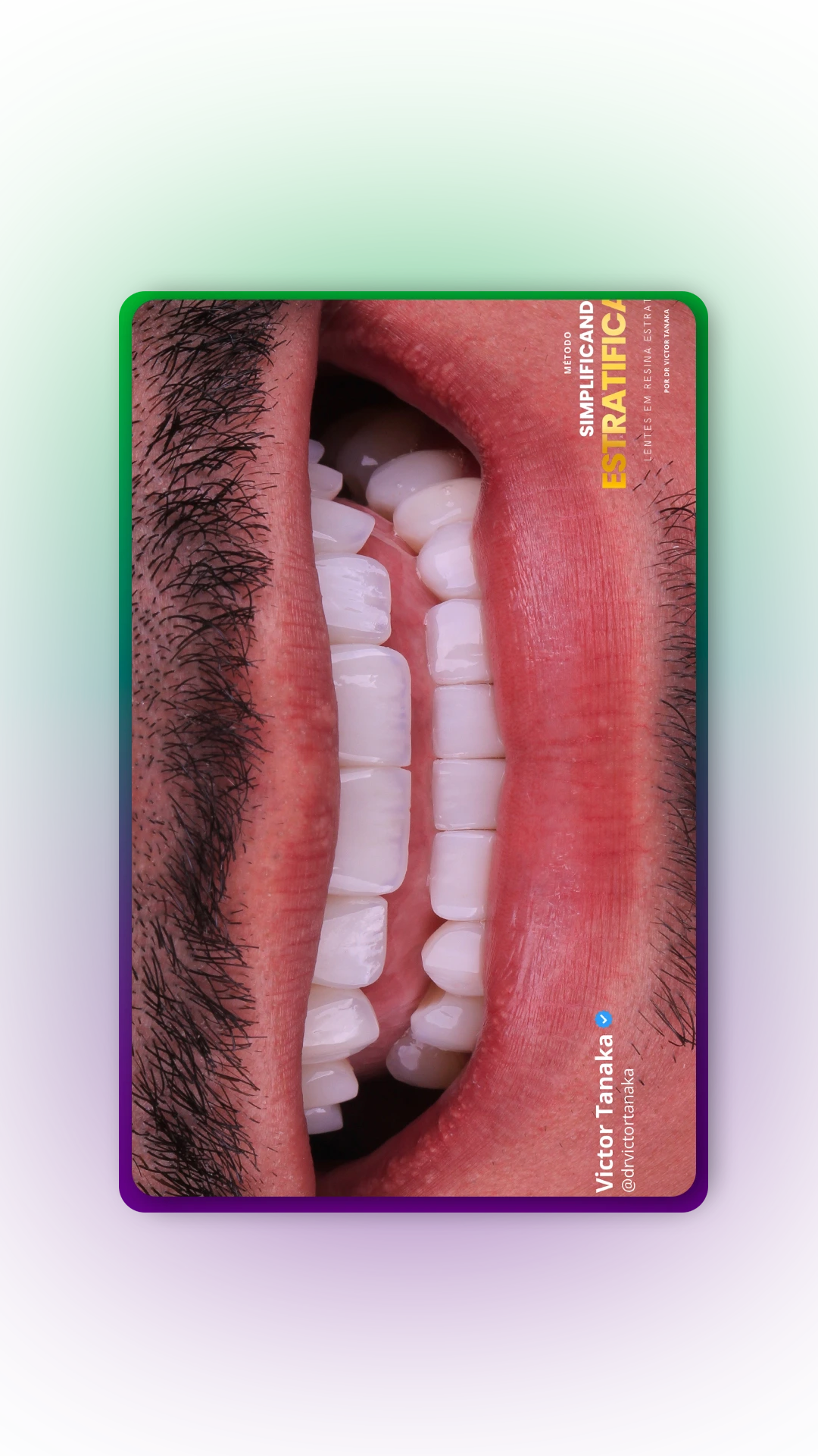 MOLD-09