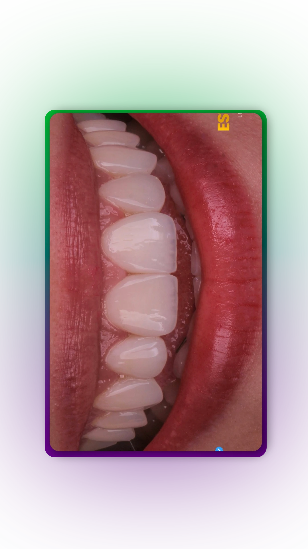 MOLD-10