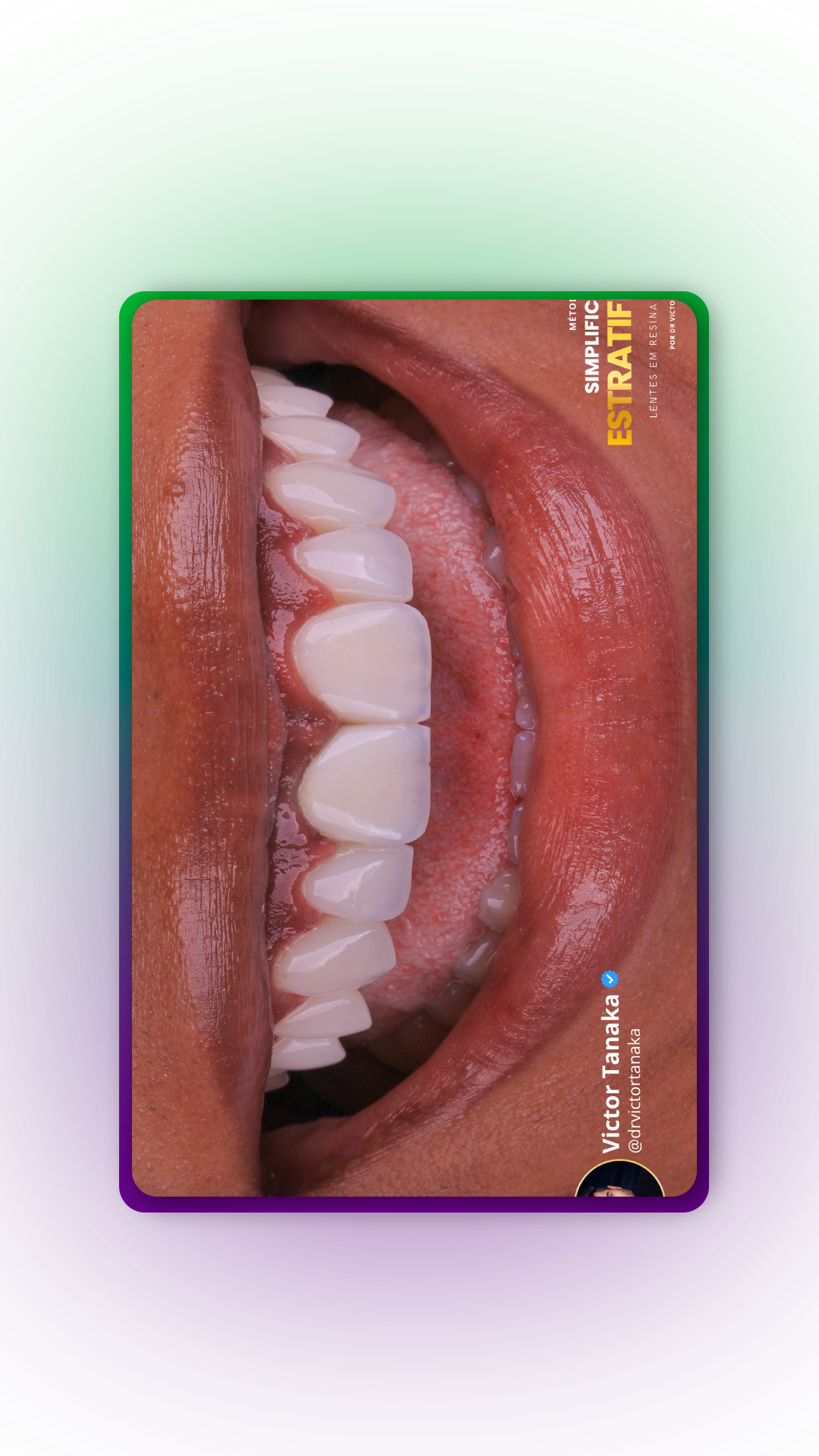 MOLD-12